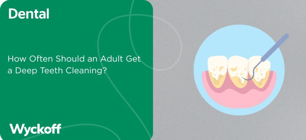 How Often Should an Adult Get a Deep Teeth Cleaning (2)