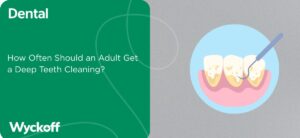 How Often Should an Adult Get a Deep Teeth Cleaning (2)