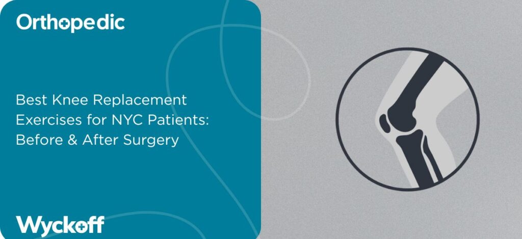 Best Knee Replacement Exercises for NYC Patients Before & After Surgery