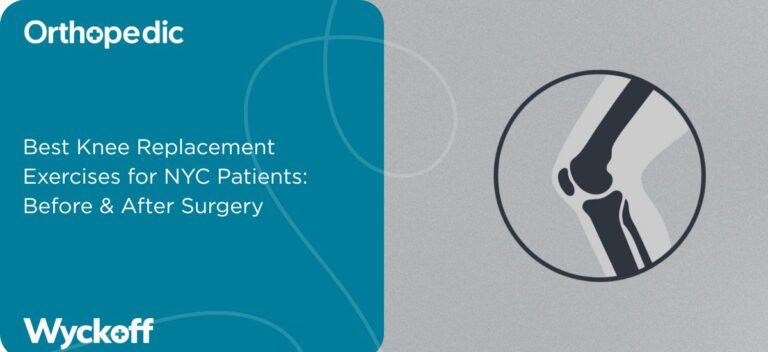 Best Knee Replacement Exercises for NYC Patients: Before & After Surgery